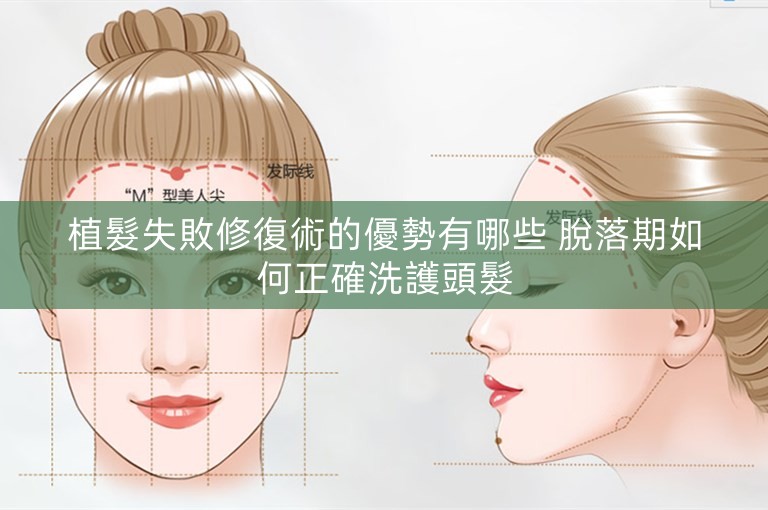 植髮失敗修復術的優勢有哪些 脫落期如何正確洗護頭髮