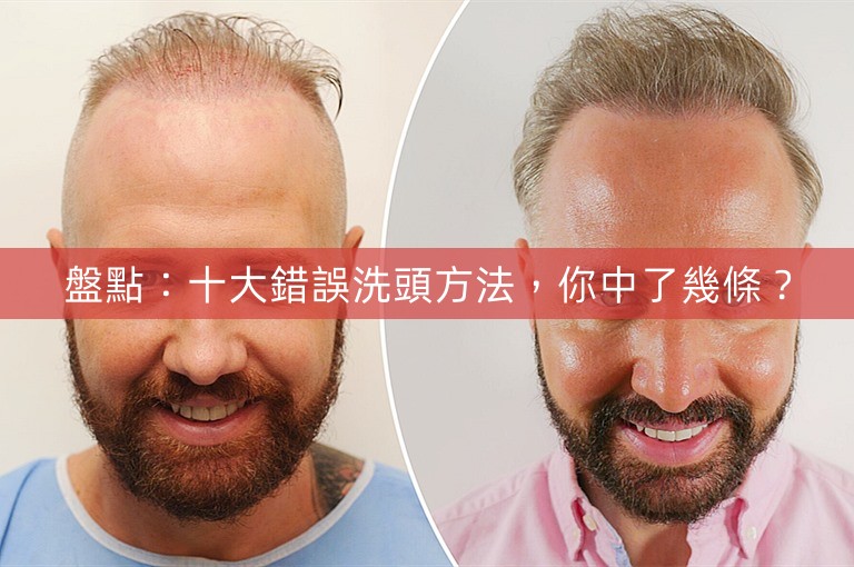 盤點：十大錯誤洗頭方法，你中了幾條？