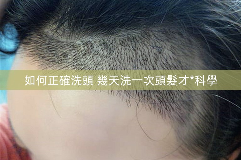 如何正確洗頭 幾天洗一次頭髮才*科學 如何正確洗頭 幾天洗一次頭髮才*科學