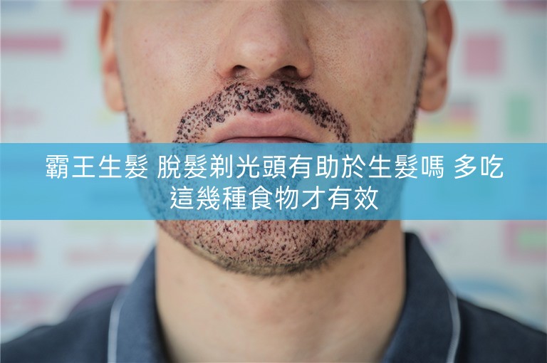 霸王生髮 脫髮剃光頭有助於生髮嗎 多吃這幾種食物才有效 霸王生髮 脫髮剃光頭有助於生髮嗎 多吃這幾種食物才有效