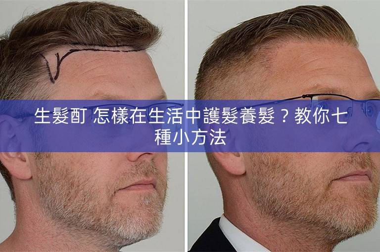 生髮酊 怎樣在生活中護髮養髮？教你七種小方法