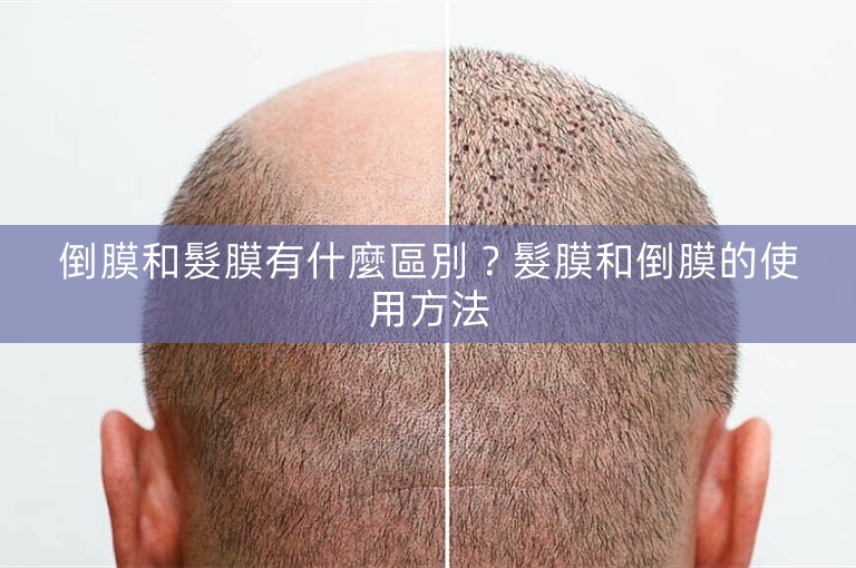 倒膜和髮膜有什麼區別?髮膜和倒膜的使用方法 倒膜和髮膜有什麼區別?髮膜和倒膜的使用方法