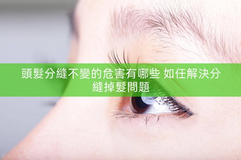 頭髮分縫不變的危害有哪些 如任解決分縫掉髮問題