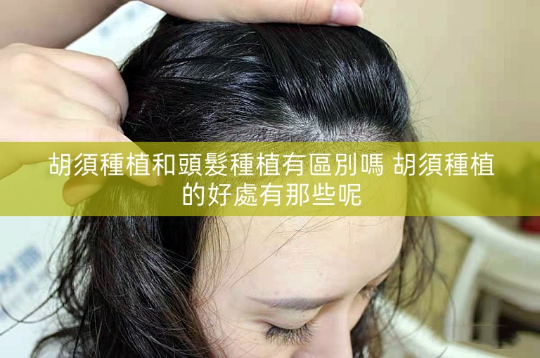 胡須種植和頭髮種植有區別嗎 胡須種植的好處有那些呢