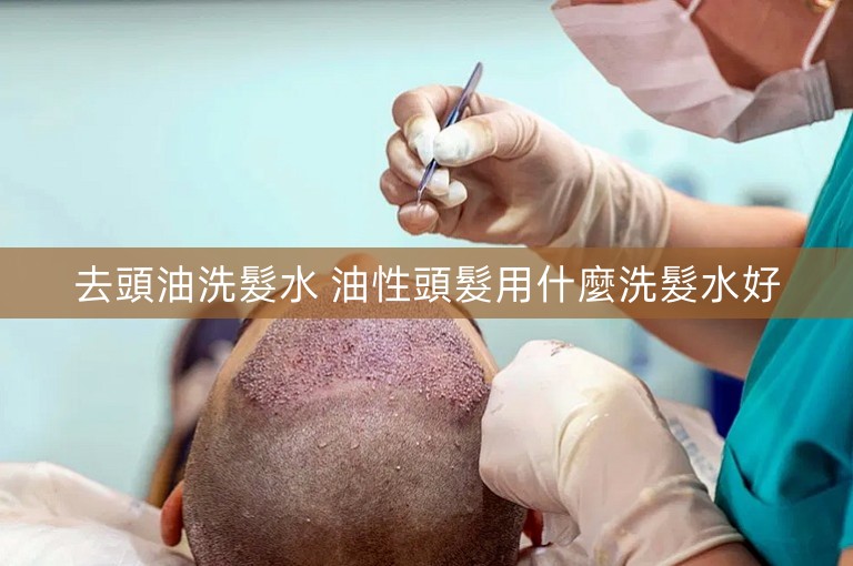 去頭油洗髮水 油性頭髮用什麼洗髮水好