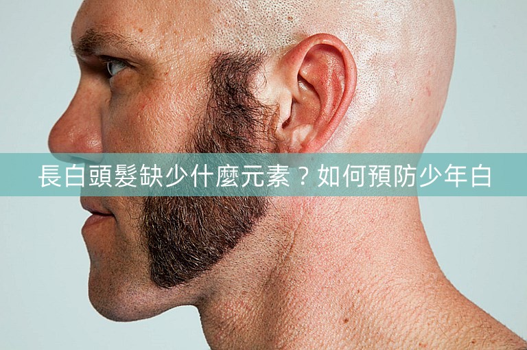 長白頭髮缺少什麼元素？如何預防少年白