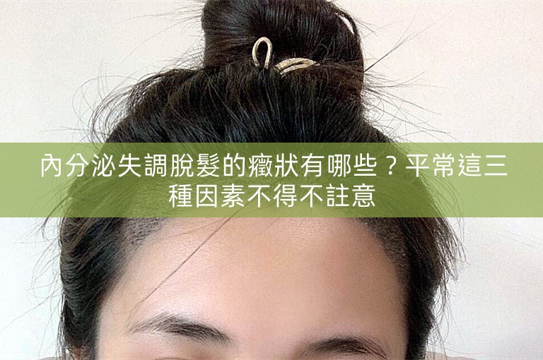 內分泌失調脫髮的癥狀有哪些?平常這三種因素不得不註意 內分泌失調脫髮的癥狀有哪些?平常這三種因素不得不註意