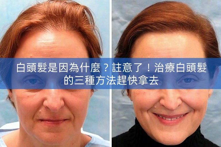 白頭髮是因為什麼?註意了!治療白頭髮的三種方法趕快拿去 白頭髮是因為什麼?註意了!治療白頭髮的三種方法趕快拿去
