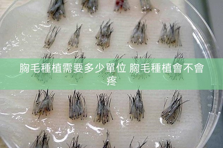 胸毛種植需要多少單位 胸毛種植會不會疼