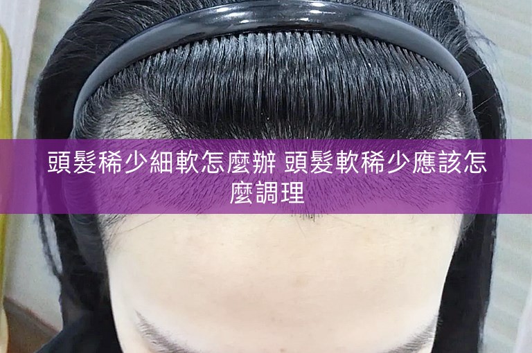 頭髮稀少細軟怎麼辦 頭髮軟稀少應該怎麼調理