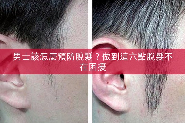 男士該怎麼預防脫髮?做到這六點脫髮不在困擾 男士該怎麼預防脫髮?做到這六點脫髮不在困擾