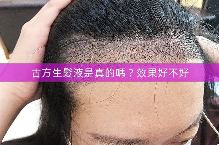 古方生髮液是真的嗎?效果好不好 古方生髮液是真的嗎?效果好不好