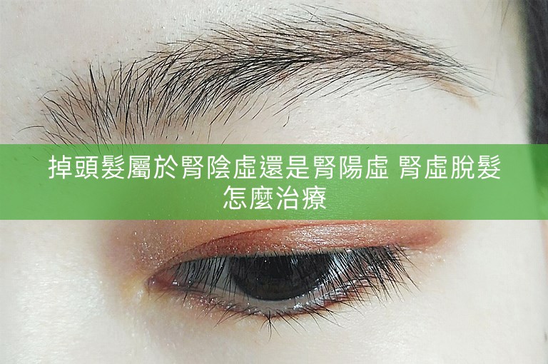 掉頭髮屬於腎陰虛還是腎陽虛 腎虛脫髮怎麼治療