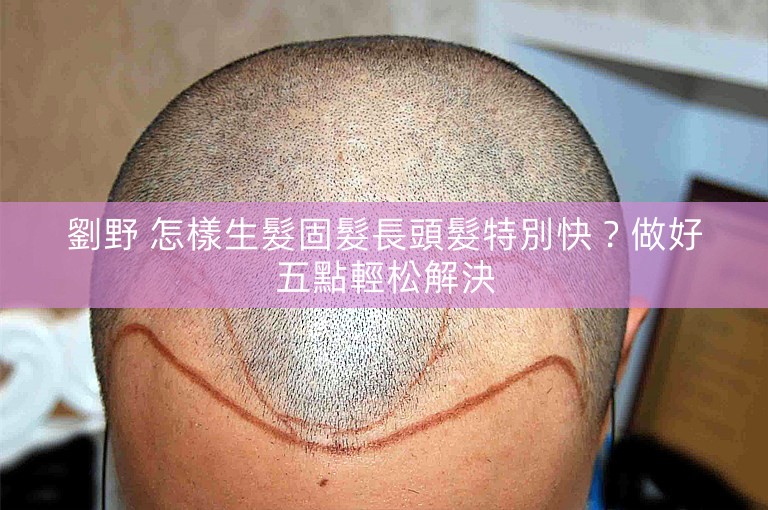 劉野 怎樣生髮固髮長頭髮特別快？做好五點輕松解決