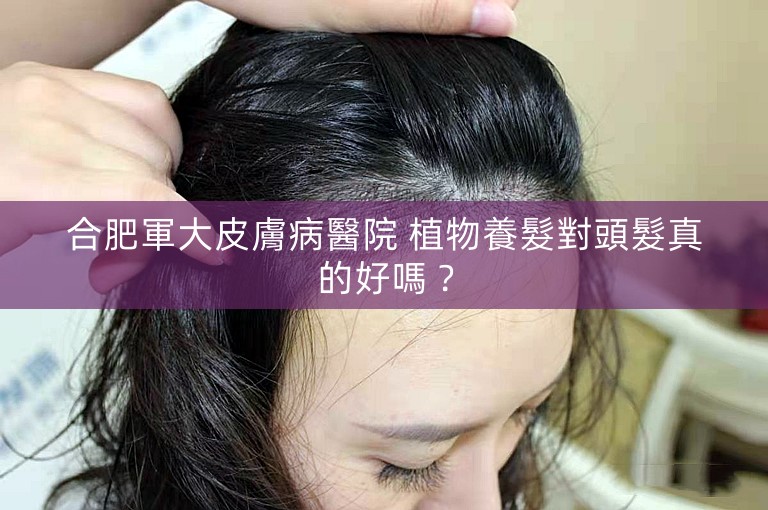 合肥軍大皮膚病醫院 植物養髮對頭髮真的好嗎？