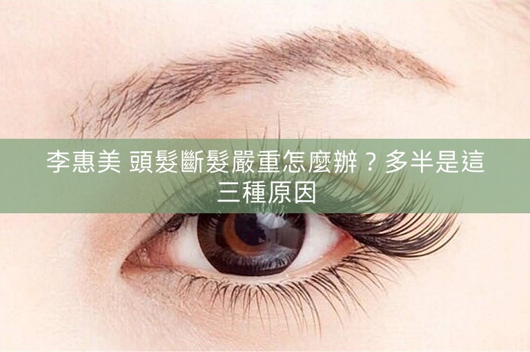 李惠美 頭髮斷髮嚴重怎麼辦?多半是這三種原因 李惠美 頭髮斷髮嚴重怎麼辦?多半是這三種原因