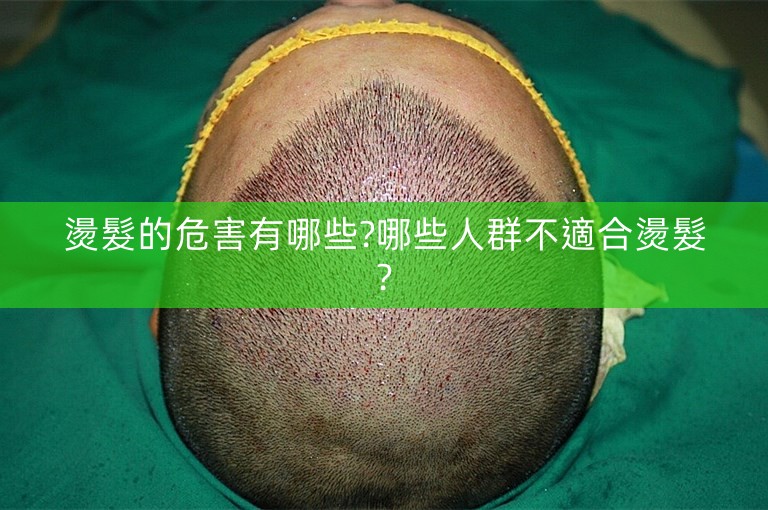 燙髮的危害有哪些?哪些人群不適合燙髮?