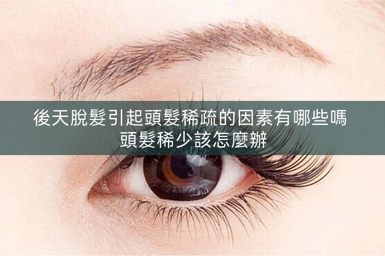 後天脫髮引起頭髮稀疏的因素有哪些嗎 頭髮稀少該怎麼辦 後天脫髮引起頭髮稀疏的因素有哪些嗎 頭髮稀少該怎麼辦