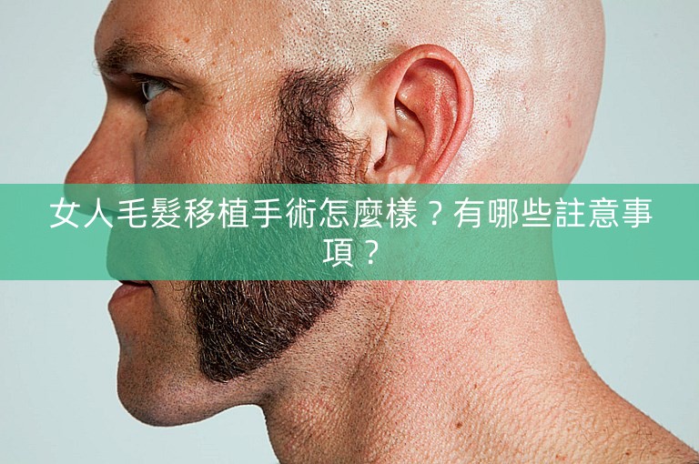 女人毛髮移植手術怎麼樣？有哪些註意事項？