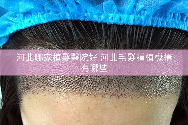 河北哪家植髮醫院好 河北毛髮種植機構有哪些