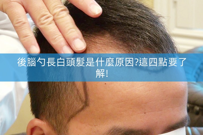 後腦勺長白頭髮是什麼原因?這四點要了解! 後腦勺長白頭髮是什麼原因?這四點要了解!