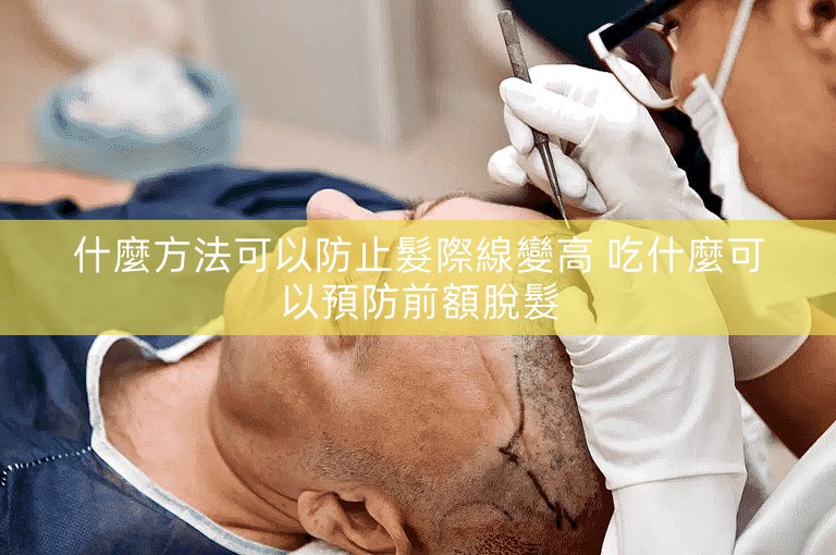 什麼方法可以防止髮際線變高 吃什麼可以預防前額脫髮 什麼方法可以防止髮際線變高 吃什麼可以預防前額脫髮