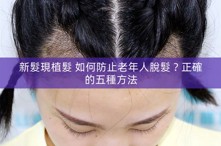 新髮現植髮 如何防止老年人脫髮？正確的五種方法