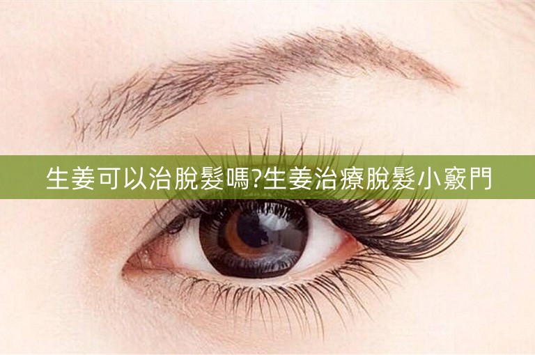 生姜可以治脫髮嗎?生姜治療脫髮小竅門