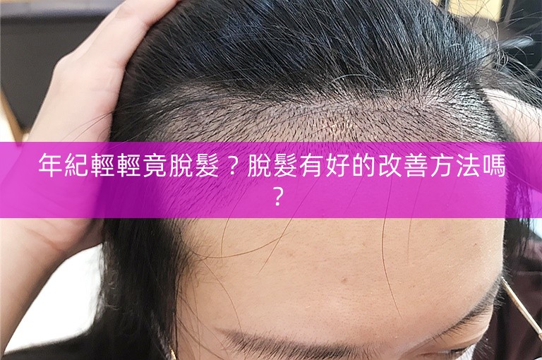 年紀輕輕竟脫髮？脫髮有好的改善方法嗎？