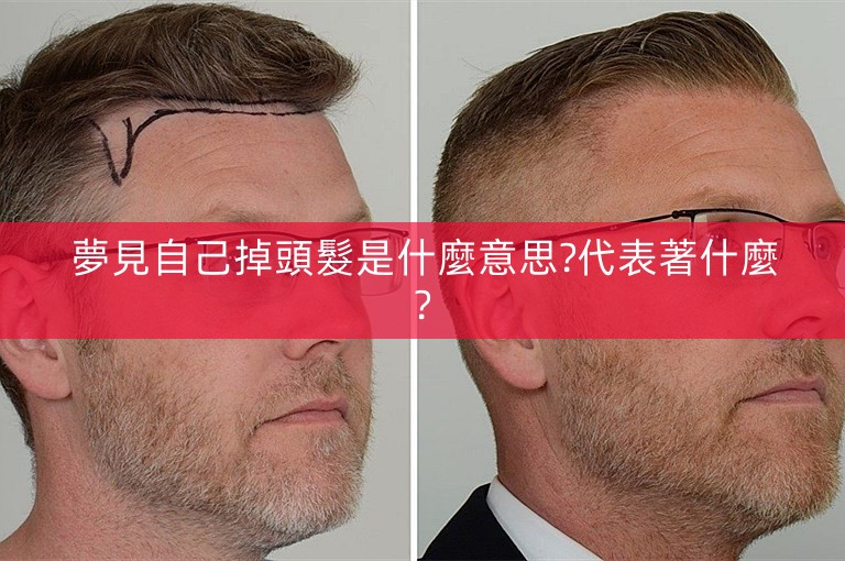 夢見自己掉頭髮是什麼意思?代表著什麼?