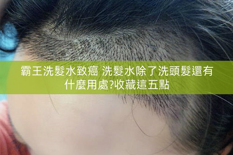 霸王洗髮水致癌 洗髮水除了洗頭髮還有什麼用處?收藏這五點