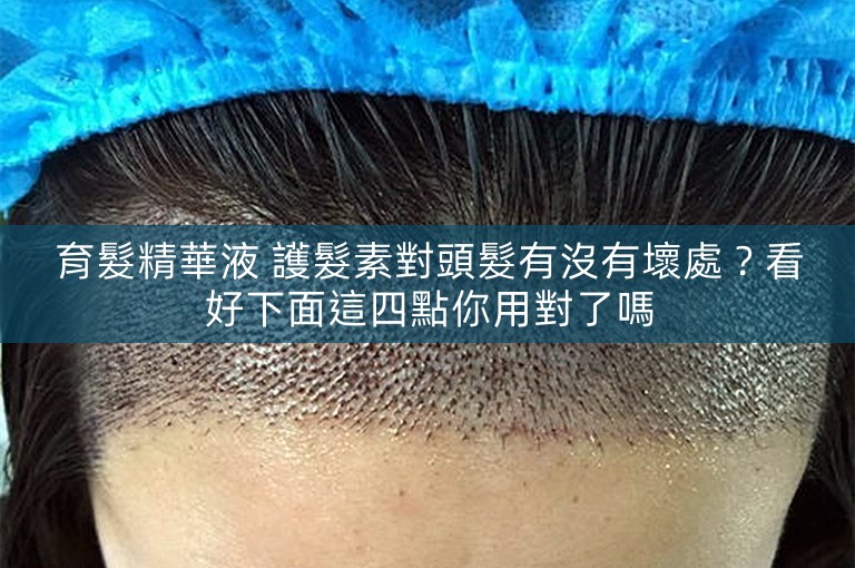 育髮精華液 護髮素對頭髮有沒有壞處？看好下面這四點你用對了嗎