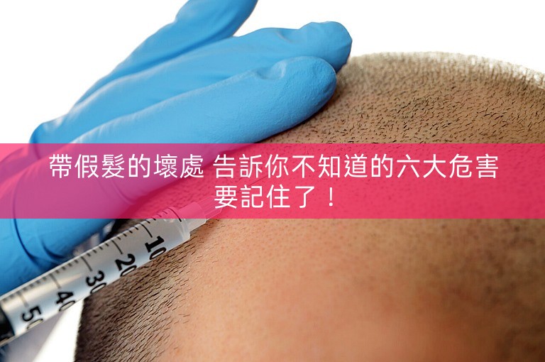 帶假髮的壞處 告訴你不知道的六大危害要記住了! 帶假髮的壞處 告訴你不知道的六大危害要記住了!