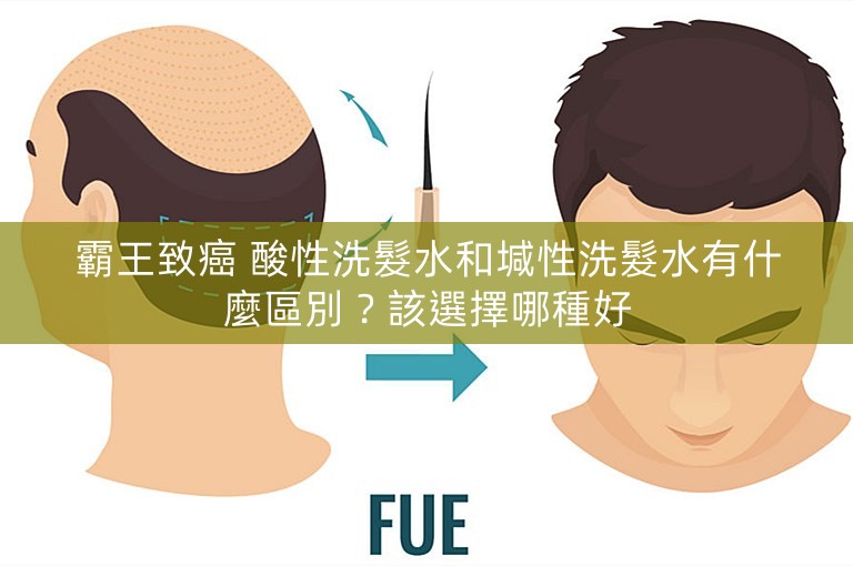 霸王致癌 酸性洗髮水和堿性洗髮水有什麼區別?該選擇哪種好 霸王致癌 酸性洗髮水和堿性洗髮水有什麼區別?該選擇哪種好