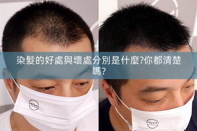 染髮的好處與壞處分別是什麼?你都清楚嗎? 染髮的好處與壞處分別是什麼?你都清楚嗎?