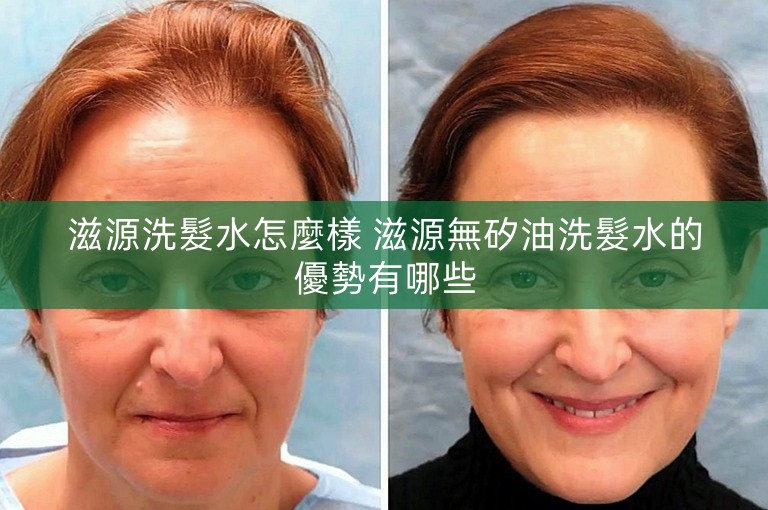 滋源洗髮水怎麼樣 滋源無矽油洗髮水的優勢有哪些 滋源洗髮水怎麼樣 滋源無矽油洗髮水的優勢有哪些