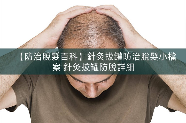 【防治脫髮百科】針灸拔罐防治脫髮小檔案 針灸拔罐防脫詳細