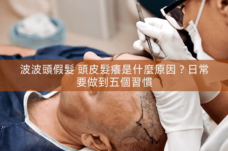 波波頭假髮 頭皮髮癢是什麼原因?日常要做到五個習慣 波波頭假髮 頭皮髮癢是什麼原因?日常要做到五個習慣