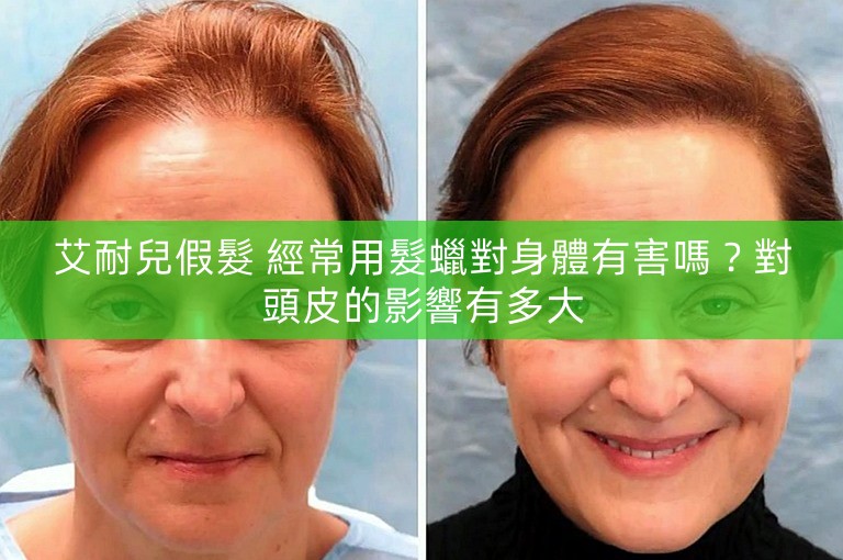 艾耐兒假髮 經常用髮蠟對身體有害嗎？對頭皮的影響有多大