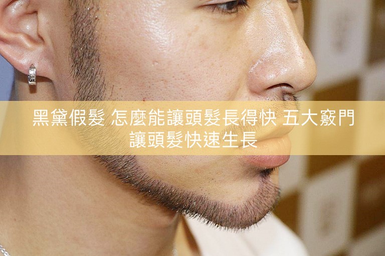 黑黛假髮 怎麼能讓頭髮長得快 五大竅門讓頭髮快速生長 黑黛假髮 怎麼能讓頭髮長得快 五大竅門讓頭髮快速生長