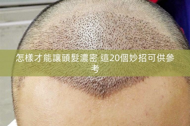 怎樣才能讓頭髮濃密 這20個妙招可供參考