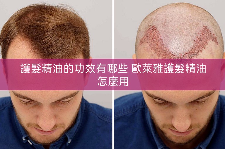 護髮精油的功效有哪些 歐萊雅護髮精油怎麼用