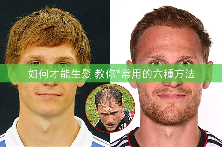 如何才能生髮 教你*常用的六種方法