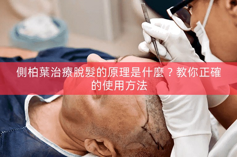 側柏葉治療脫髮的原理是什麼？教你正確的使用方法