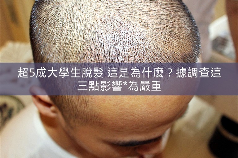 超5成大學生脫髮 這是為什麼？據調查這三點影響*為嚴重