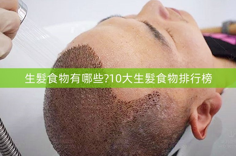 生髮食物有哪些?10大生髮食物排行榜 生髮食物有哪些?10大生髮食物排行榜