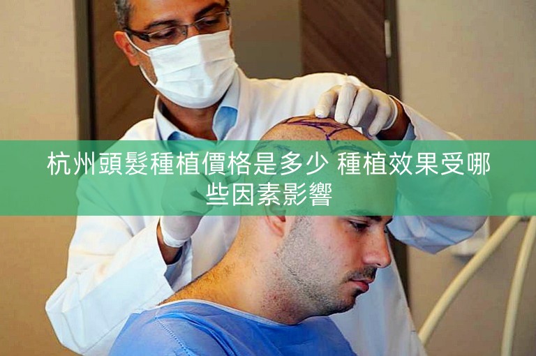 杭州頭髮種植價格是多少 種植效果受哪些因素影響