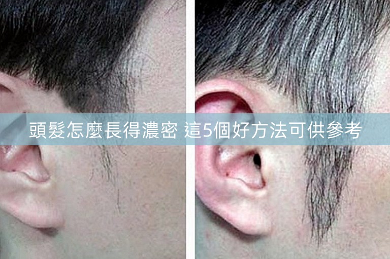 頭髮怎麼長得濃密 這5個好方法可供參考