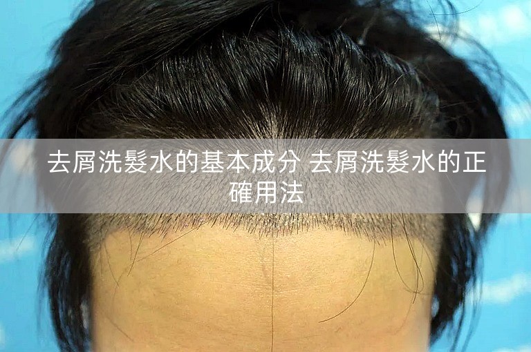 去屑洗髮水的基本成分 去屑洗髮水的正確用法 去屑洗髮水的基本成分 去屑洗髮水的正確用法