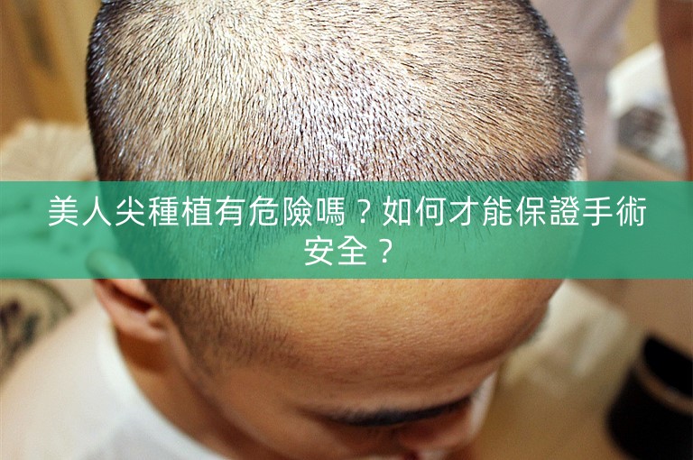 美人尖種植有危險嗎？如何才能保證手術安全？